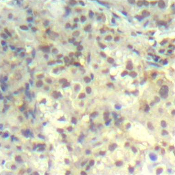 Anti-CFL1 (phospho Y139) Antibody