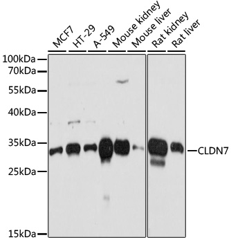 Anti-CLDN7 Antibody
