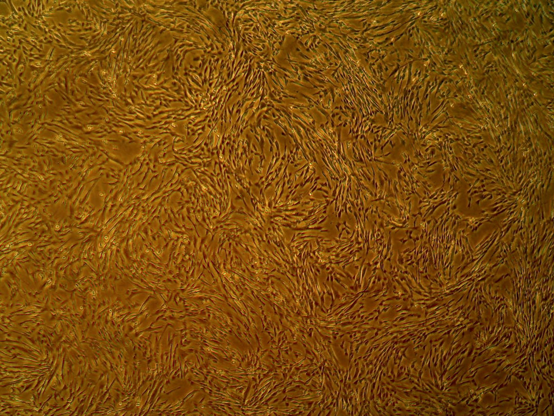 Primary Human Aortic Smooth Muscle Cells