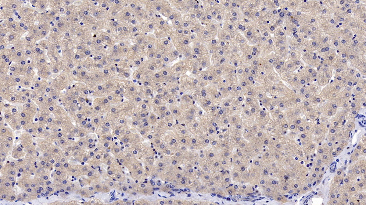 DAB staining on IHC-P; Samples: Human Liver Tissue;  Primary Ab: 10µg/ml Mouse Anti-Human LEP Antibody Second Ab: 2µg/mL HRP-Linked Caprine Anti-Mouse IgG Polyclonal Antibody (Catalog: SAA544Mu19)
