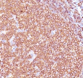 IHC testing of anti-CD20 antibody (clone SPM618) and FFPE human tonsil tissue.