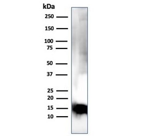 Western blot testing of human brain lysate with Myelin Basic Protein antibody (clone MBP/4275). Isoforms may be visualized from 20~37 kDa.