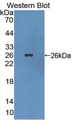 Western Blot; Sample: Recombinant protein.