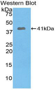 Western Blot; Sample: Recombinant protein.