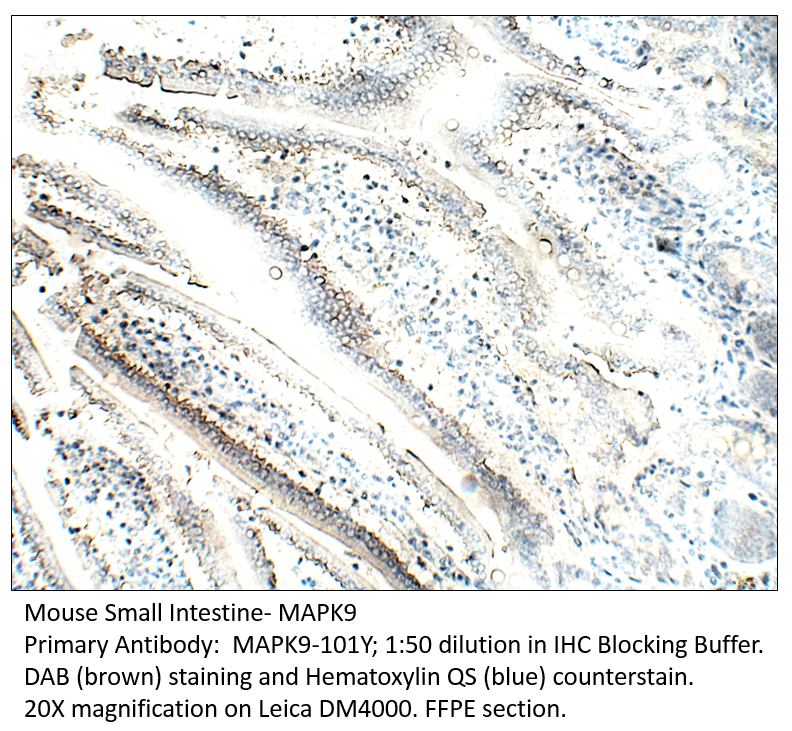 Anti-MAPK9 Antibody