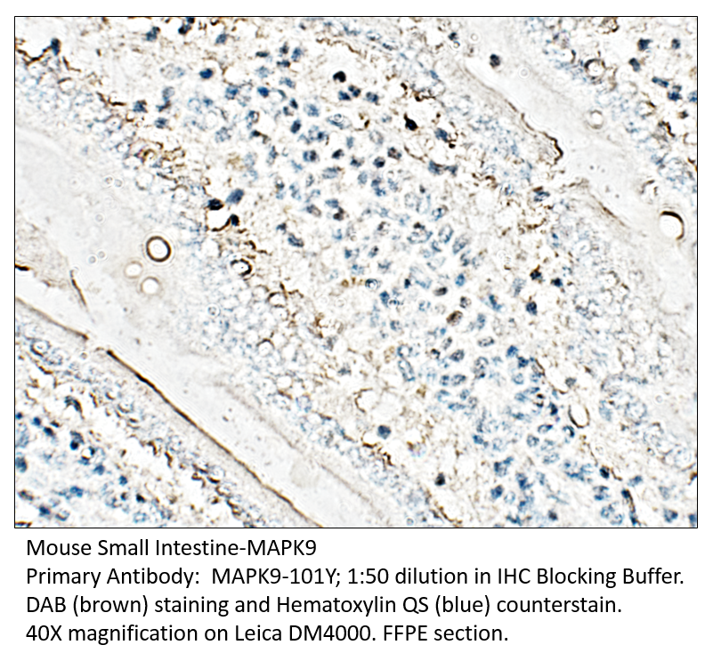 Anti-MAPK9 Antibody