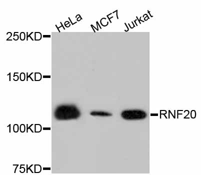 Anti-RNF20 Antibody [Assigned #A11410]