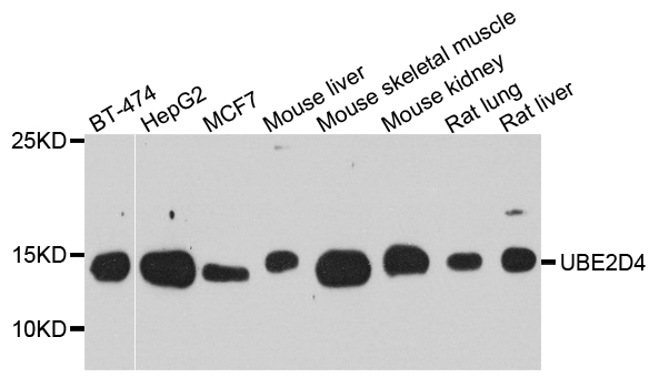 Anti-UBE2D4 Antibody