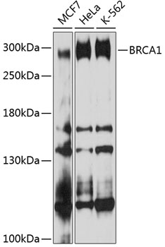 Anti-BRCA1 Antibody