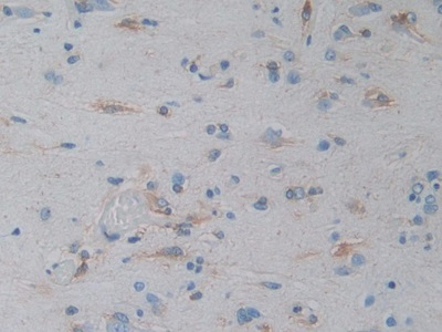 DAB staining on IHC-P; Sample: Human Brain Tissue;  Primary Ab: 30µg/ml Mouse Anti-Human Hsp27 Antibody Second Ab: 2µg/mL HRP-Linked Caprine Anti-Mouse IgG Polyclonal Antibody (Catalog: SAA544Mu19)