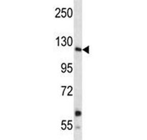 Insulin receptor R antibody western blot analysis in A549 lysate. Expected size: ~80 kDa, 144 kDa