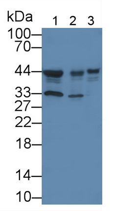 Western Blot; Sample: Lane2: Rat Cerebrum lysate; Lane2: Human Hela cells lysate; Lane3: Human K562 cells lysate;<br/>Primary Ab: 3µg/ml Mouse Anti-Human CSNK1d Antibody<br/>Second Ab: 0.2µg/mL HRP-Linked Caprine Anti-Mouse IgG Polyclonal Antibody<br/>(Catalog: SAA544Mu19)