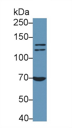 Western Blot; Sample: K562 cell lysate Primary Ab: 0.5µg/ml Mouse Anti-Human PARP Antibody Second Ab: 0.2µg/mL HRP-Linked Caprine Anti-Mouse IgG Polyclonal Antibody (Catalog: SAA544Mu19)