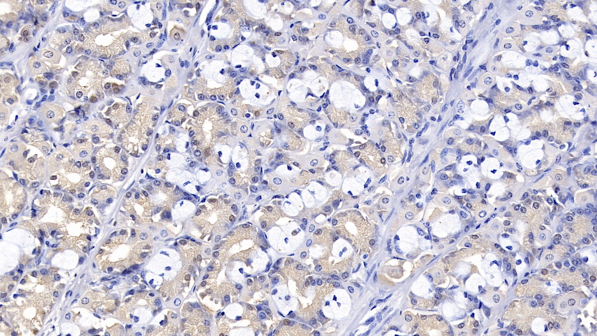 DAB staining on IHC-P; Sample: Human Stomach Tissue;  Primary Ab: 10µg/ml Mouse Anti-Human IL1RA Antibody Second Ab: 2µg/mL HRP-Linked Caprine Anti-Mouse IgG Polyclonal Antibody (Catalog: SAA544Mu19)