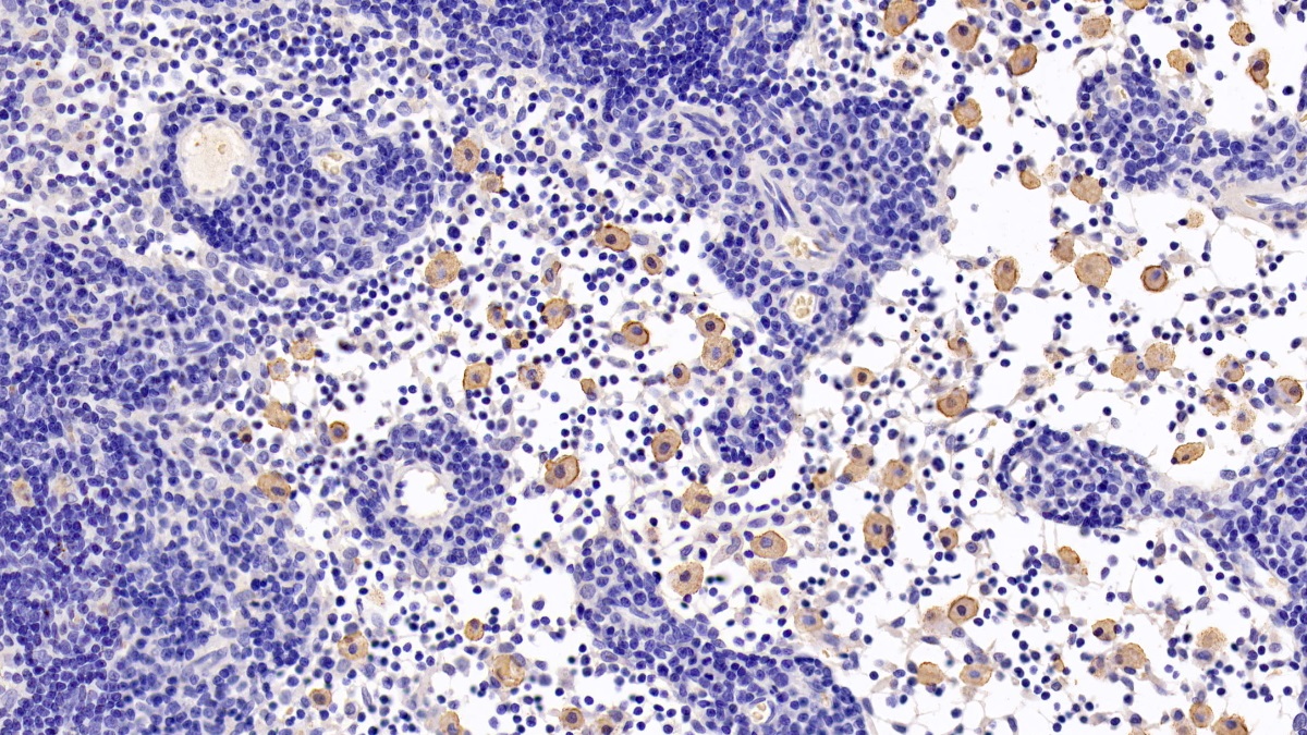 CASP8 Monoclonal Antibody,(Human/Rat), 100ul | Labscoop