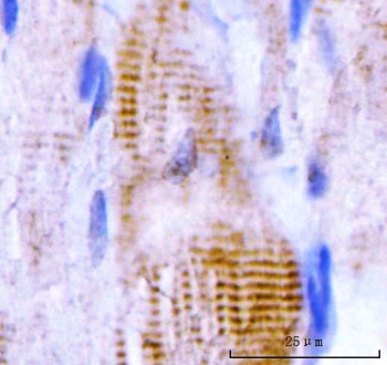 IHC staining of FFPE rat skeletal muscle tissue with M Cadherin antibody. HIER: boil tissue sections in pH8 EDTA for 20 min and allow to cool before testing.