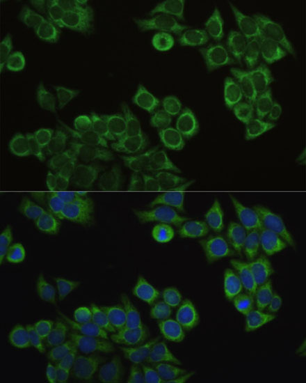 Anti-ECHS1 Antibody