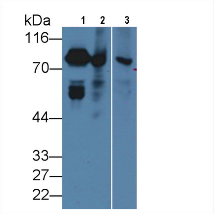 Western Blot; Sample: Lane1: Rat Serum; Lane2: Rat Liver lysate; Lane3: Rat Spleen lysate Primary Ab: 1µg/ml Mouse Anti-Rat F2 Antibody Second Ab: 0.2µg/mL HRP-Linked Caprine Anti-Mouse IgG Polyclonal Antibody (Catalog: SAA544Mu19)