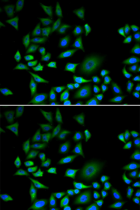 Anti-CDKN2A Antibody