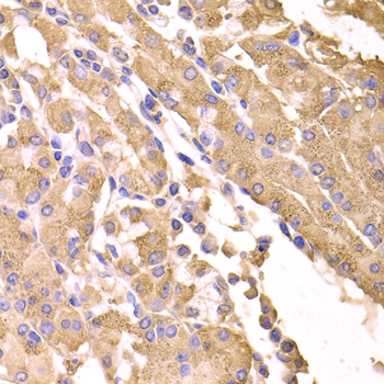 Anti-SUFU Antibody