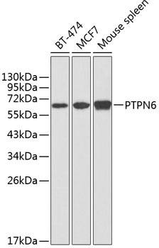 Anti-PTPN6 Antibody