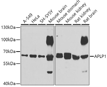 Anti-APLP1 Antibody