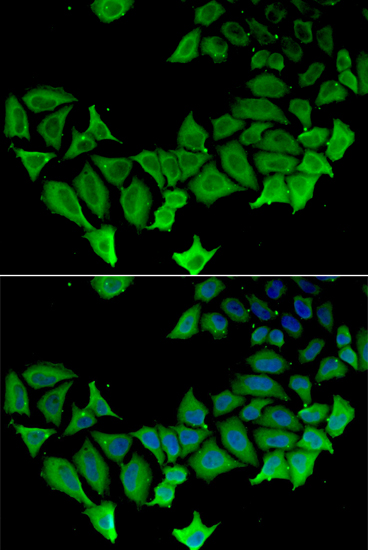 Anti-APLP1 Antibody