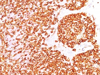 IHC staining of FFPE human tonsil with recombinant CD45R antibody (clone rPTPRC/1460). HIER: steam section in pH 9 10mM Tris with 1mM EDTA for 20 min and allow to cool prior to staining.