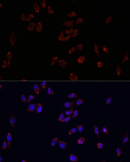 Anti-PLIN2 Antibody