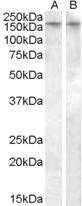 Anti-AVPR1B Antibody