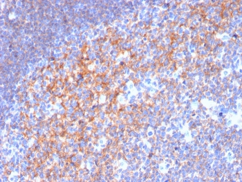 IHC staining of FFPE human tonsil with CD19 antibody (clone CD19/3116). HIER: boil tissue sections in pH 9 10mM Tris with 1mM EDTA for 10-20 min and allow to cool before testing.