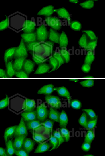 Anti-ASPH Antibody