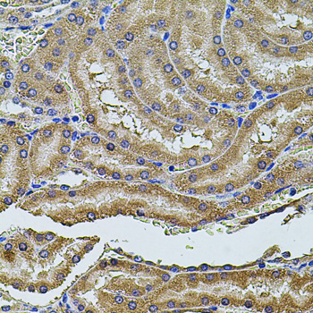 Anti-PDCD6IP Antibody