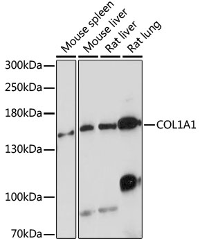 Anti-COL1A1 Antibody