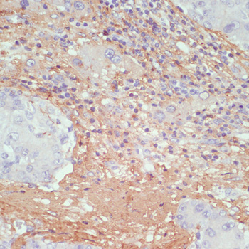 Anti-COL1A1 Antibody