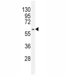 Anti-MDM2 antibody western blot analysis in HepG2 lysate