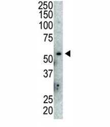Western blot analysis of anti-MDM2 antibody and mouse lung tissue lysate