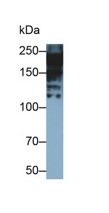 Western Blot; Sample: Porcine Skeletal muscle lysate&lt;br/&gt;Primary Ab: 0.02µg/ml Mouse Anti-Human MYH7 Antibody&lt;br/&gt;Second Ab: 0.2µg/mL HRP-Linked Caprine Anti-Mouse IgG Polyclonal Antibody&lt;br/&gt;(Catalog: SAA544Mu19)