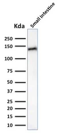 Anti-LI Cadherin Antibody [CDH17/2617]