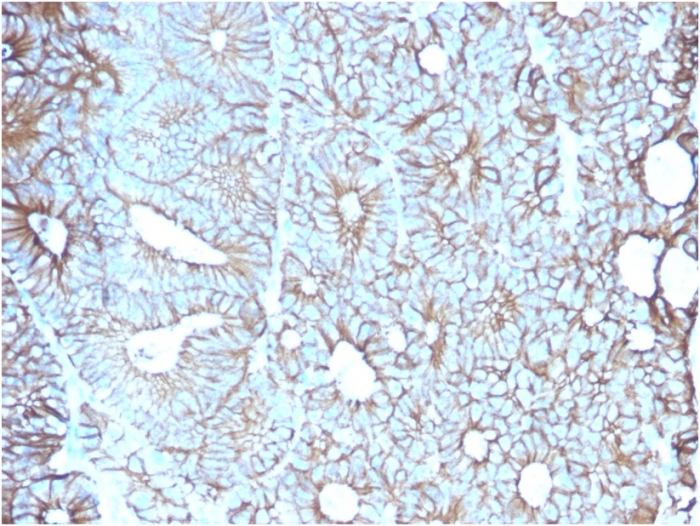 Anti-LI Cadherin Antibody [CDH17/2617]