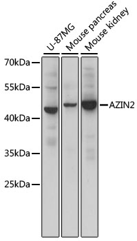 Anti-AZIN2 Antibody