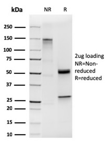 Anti-Cytokeratin 19 Antibody [KRT19/1959R]