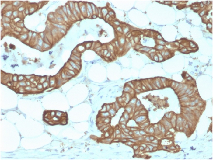 Anti-Cytokeratin 19 Antibody [KRT19/1959R]