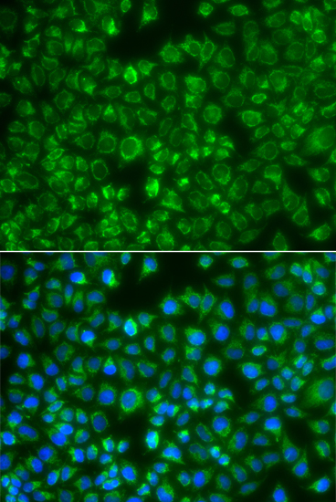 Anti-MTMR4 Antibody