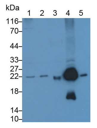 Western Blot; Sample: Lane1: Hela cell lysate; Lane2: HepG2 cell lysate; Lane3: Mouse Serum; Lane4: Mouse Liver lysate; Lane5: Mouse Cerebrum lysate<br/>Primary Ab: 0.1µg/ml Rabbit Anti-Mouse PARK7 Antibody<br/>Second Ab: 0.2µg/mL HRP-Linked Caprine Anti-Rabbit IgG Polyclonal Antibody<br/>(Catalog: SAA544Rb19)