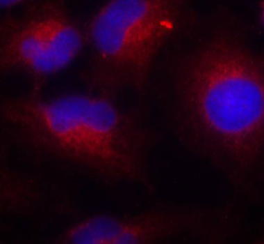 Anti-PTEN (phospho S380) Antibody