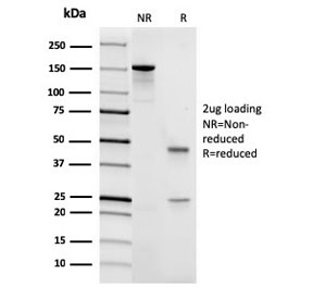 SDS-PAGE analysis of purified, BSA-free recombinant CD45 antibody (clone rPTPRC/1461) as confirmation of integrity and purity.