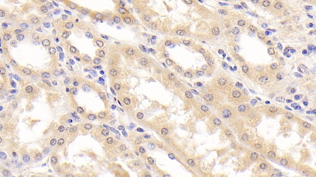 DAB staining on IHC-P;<br/>Samples: Human Kidney Tissue; <br/>Primary Ab: 30µg/ml Mouse Anti-Human RBP4 Antibody<br/>Second Ab: 2µg/mL HRP-Linked Caprine Anti-Mouse IgG Polyclonal Antibody<br/>(Catalog: SAA544Mu19)