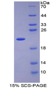 Figure. SDS-PAGE
