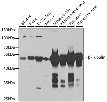 Anti-beta Tubulin Antibody